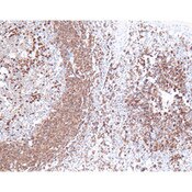 CD79a